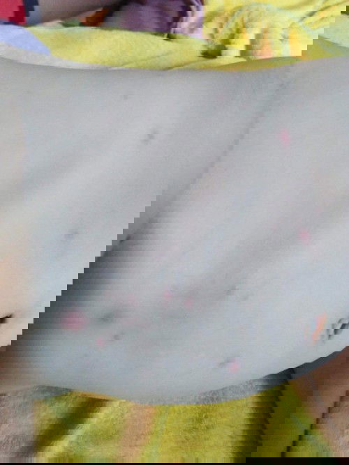 พอทราบไมค่ะว่าเป็นอะไร