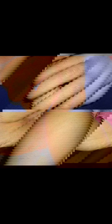 Beruntusan seperti ada airnya