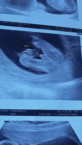 15w+6 สอบถามหน่อยค่า