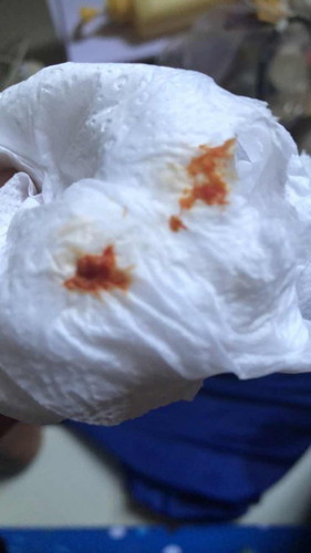 มูกเลือดออกมาพร้อมปัสสาวะ