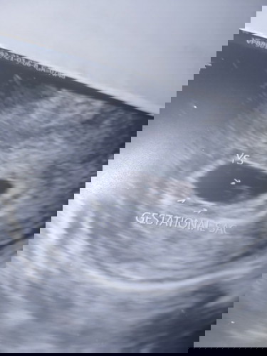 6weeks and 2days! Helpppp