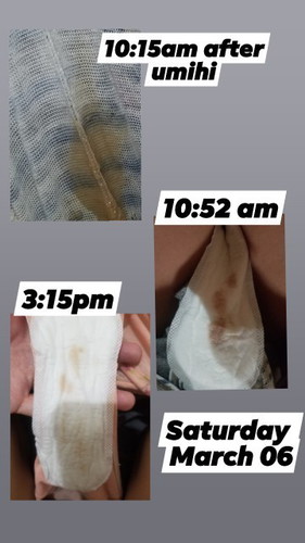 Placenta previa .Sobra nako nag aalala 🥺 sana may makapansin