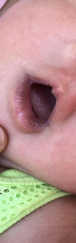 สอบถามเรืองสีปากของลูก