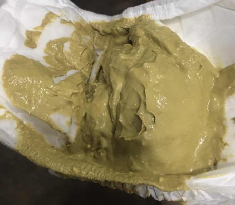 สีอึ้ลูกแบบนี้ผิดปกติไหม