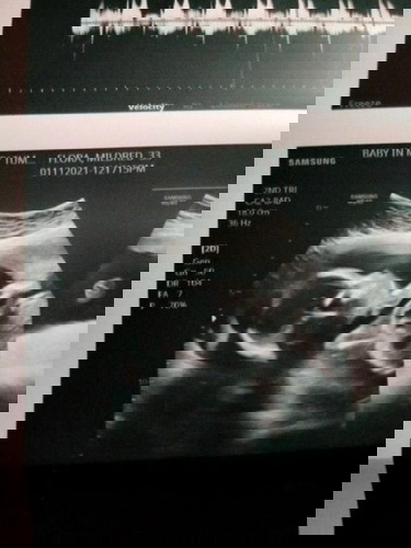 Parents name Mildred and Christian ,pa suggest naman po ng baby girl name😊 salamat po