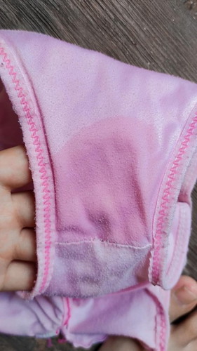 ขออนุญาตสอบถามพี่ๆค่ะ น้ำอะไรมันออกที่ละนิดๆ มันคือน้ำอะไรค่ะไม่เหลืองเเต่ใส่