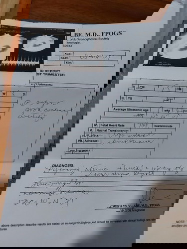 What is the gender of my baby?