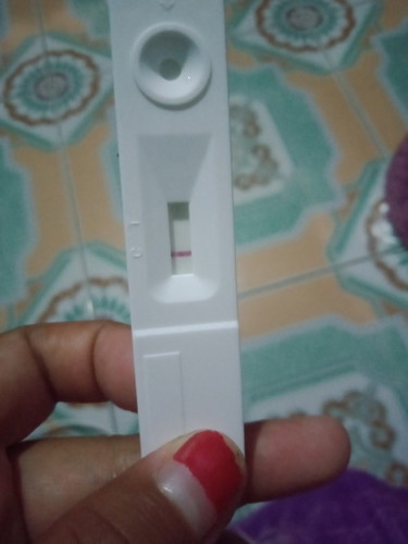 ขอประสบการณ์ของคุณแม่หน่อยค่ะ