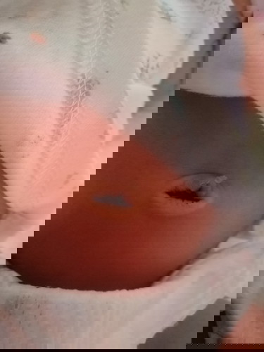 Umbilical/pusod