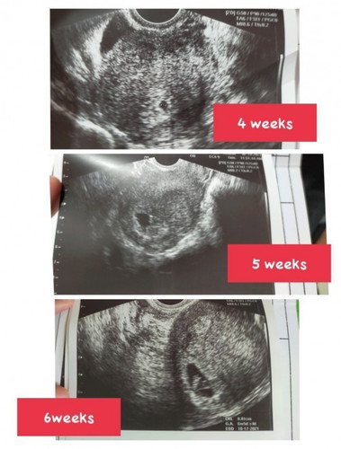 Blessing 🤰