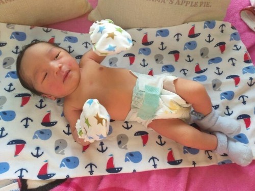 Labor + emergency C-Section