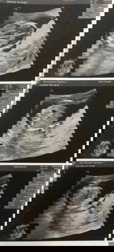 เพศอะไรน่า ลุ้นมากๆเลยจ้า ทีมสิงหา