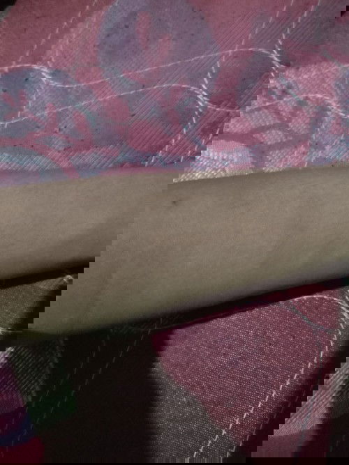 Kulit kering kaya kulit mati