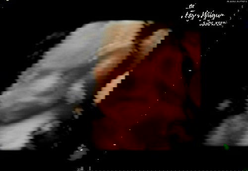 Tebak jk dong bunn😁😁