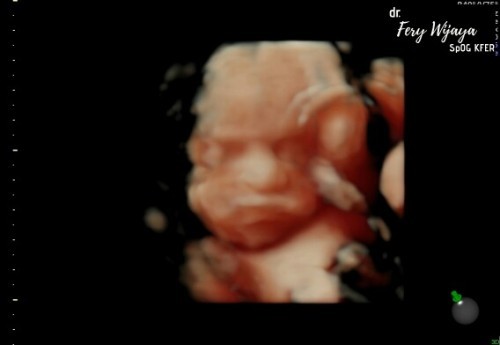 Tebak jk dong bunn😁😁