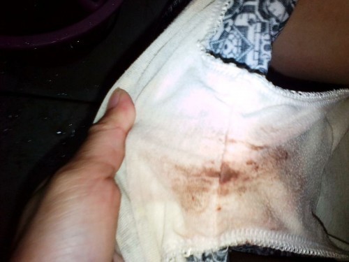 pasintabi po sa kumain , normal lang po ba to .2months na po tyan ko . nag spotting po ako .