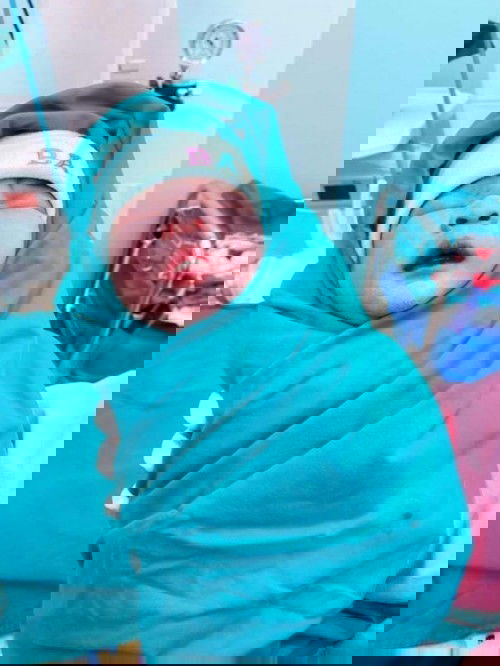 แตกแล้วค่ะ 38+3 ผ่าคลอด