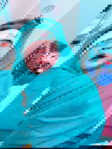 แตกแล้วค่ะ 38+3 ผ่าคลอด