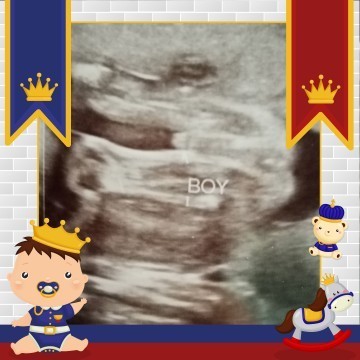 แม่ๆทีม ก.ค.64 น้องน้ำหนักเท่าไรบ้างค่ะ บ้านนี้ผู้ชายหนัก519กรัม22+3วัน