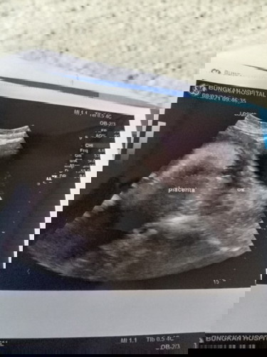 ทีมพฤษภาคม