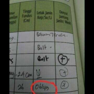 Arti letak janin