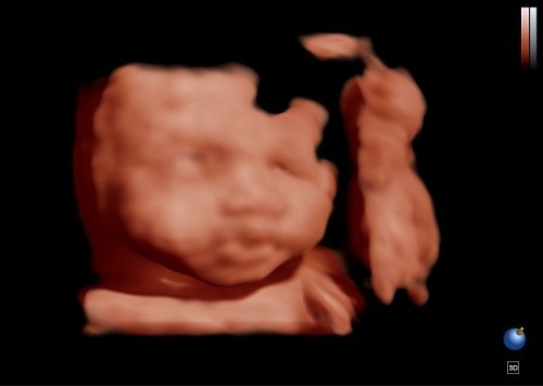 26w 1d ลูกคนแรกของฉัน 💝