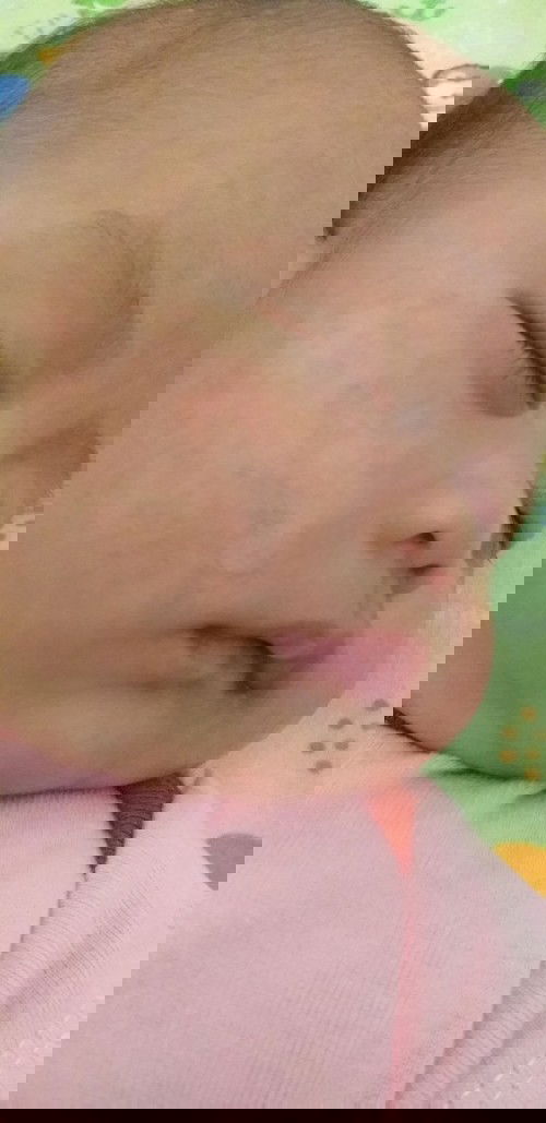 Bercak putih di wajah