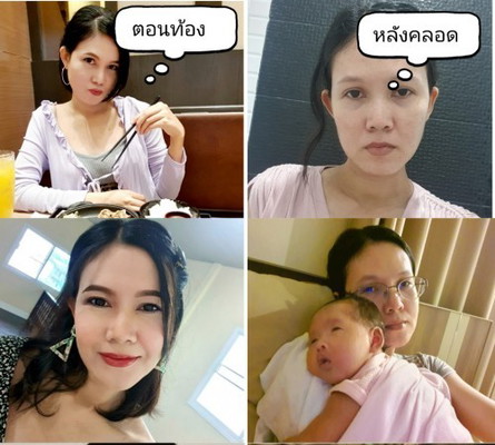 สภาพหลังคลอดเป็นไงกันบ้างคะ