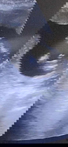 แม่ๆว่าแบบนี้เพศอะไรคะ