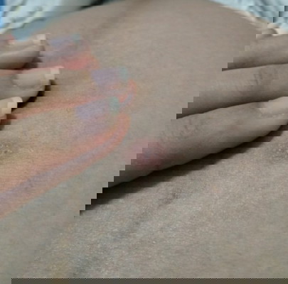 มีใครเคยเป็นแบบนี้มั้ยคะ