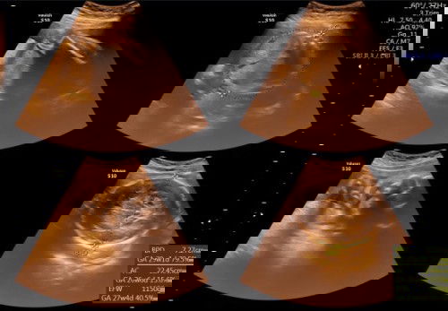 mohon di jwab bunda2. 😔