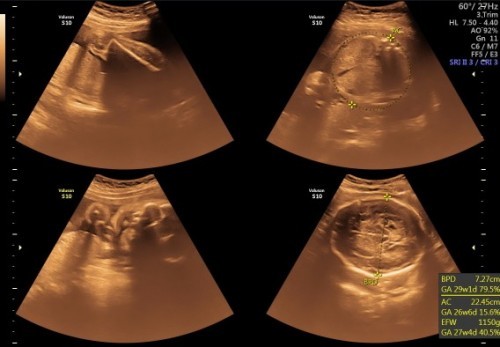 mohon di jwab bunda2. 😔