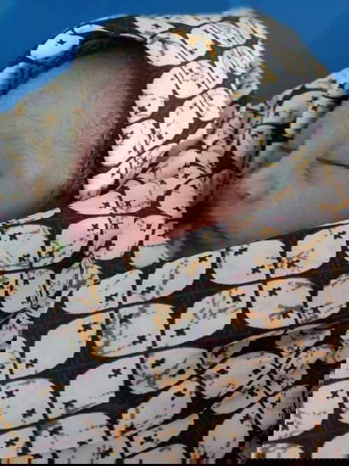 lahir sungsang normal tanpa jahitan
anak pertama 
berat badan bayinya 2,5kg
ibu dan bayinya sehat.🥰