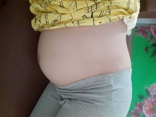 27วีคแล้ว เจ็บขาหนีบซ้ายมากๆๆ