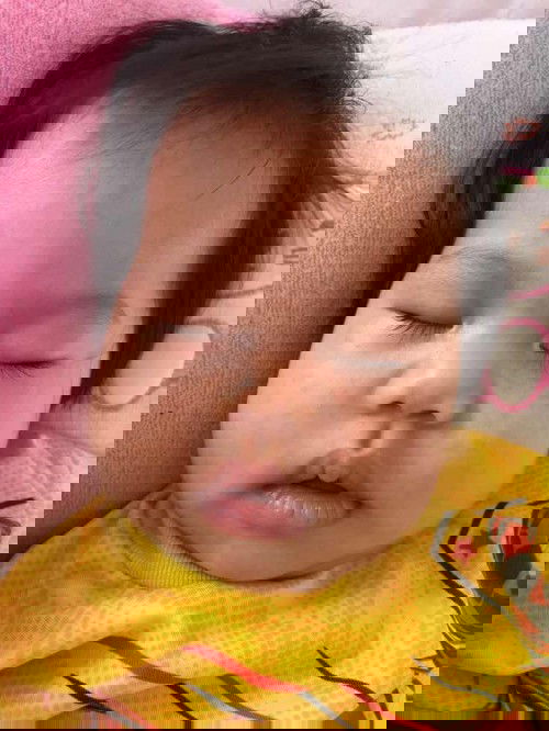 อาการลูกน้อย