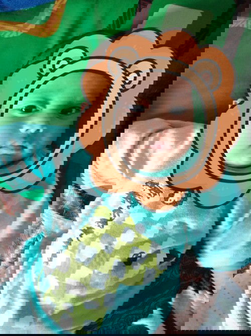 Kelopak bawah mata bayi