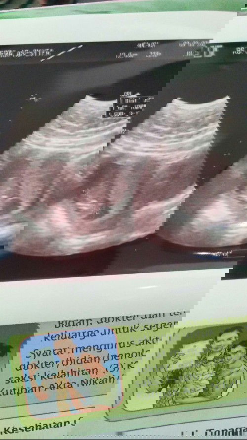 Apa perbedaan mm dan cm di hasil usg