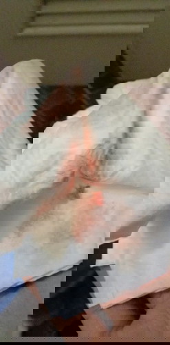 ท้องได้24สัปดาห์แล้ววันนี้เข้าห้องน้ำแล้วมีเลือดออก อันตรายไหมคะ