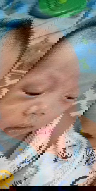 ผื่นเเบบนี้หายเองไหมคะ