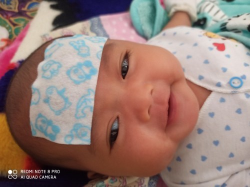 anak demam