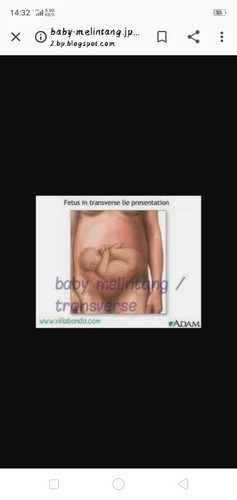 Hay ibu sy nk tnya ada x kes mcm sy scan 28w songsang dan scan 34 w melintang ada x bby akan pusing