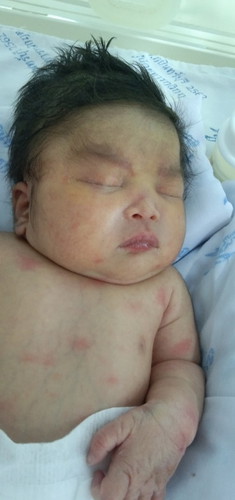 น้องคลอดก่อนกำหนด👶