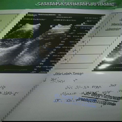 Mohon jawabannya bun