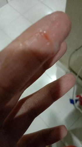 Lendir bercampur darah