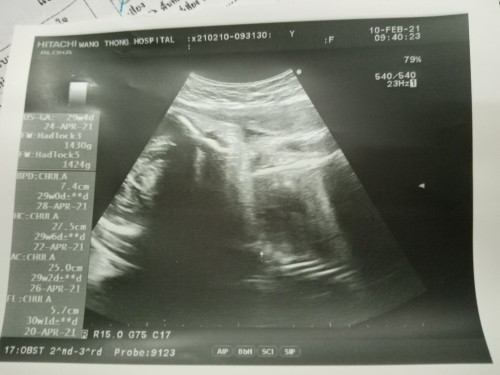 ลูกเสียตั้งแต่อยู่ในครรภ์