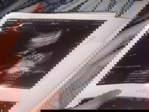 ขอสอบถามหน่อยค่ะแม่ๆ