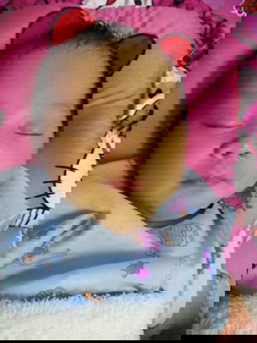 ทารก 7 วัน มีอาการ 0verfeeding