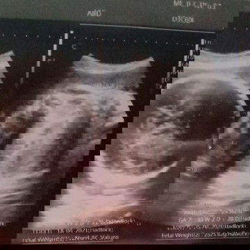 Mimpi aneh saat hamil