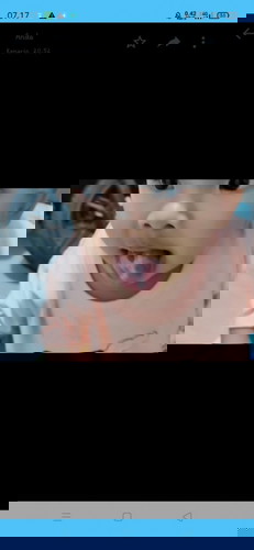 Lidah bayi ada bercaknya