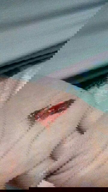 Flek seperti darah kental